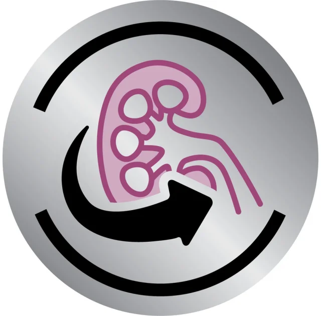 Сухий корм Royal Canin Renal при нирковій недостатності у собак, 2 кг