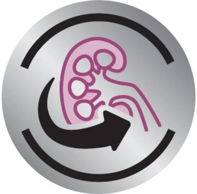 Вологий корм Royal Canin Renal при хронічній нирковій недостатності у собак, 410 г